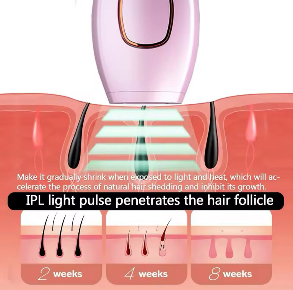Depiladora Láser IPL Permanente con 600,000 Pulsos - 5 Niveles