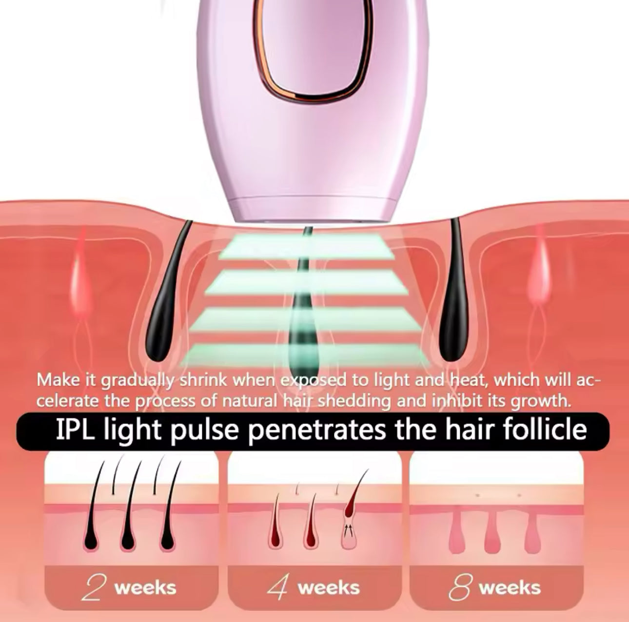 Depiladora Láser IPL Permanente con 600,000 Pulsos - 5 Niveles